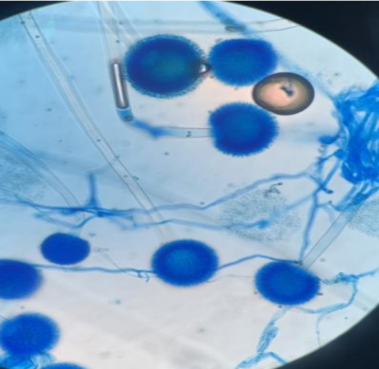 生物氣溶膠